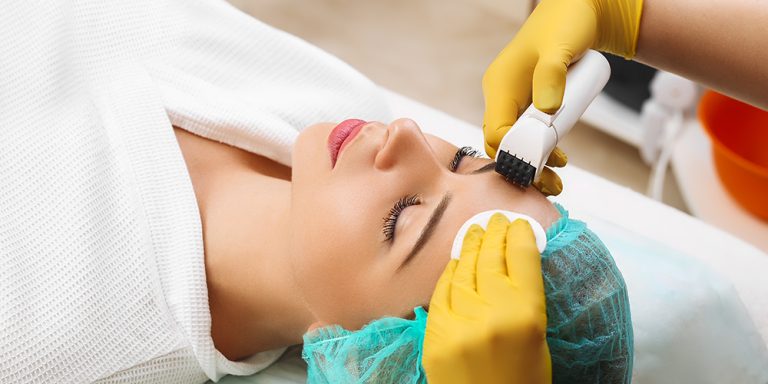 Dermarolleres kezelés